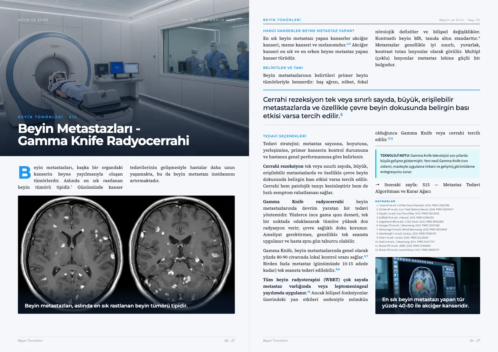Beyin ve Sinir Sayı 01 — Beyin Metastazları - Gamma Knife Radyocerrahi · s. 26–27