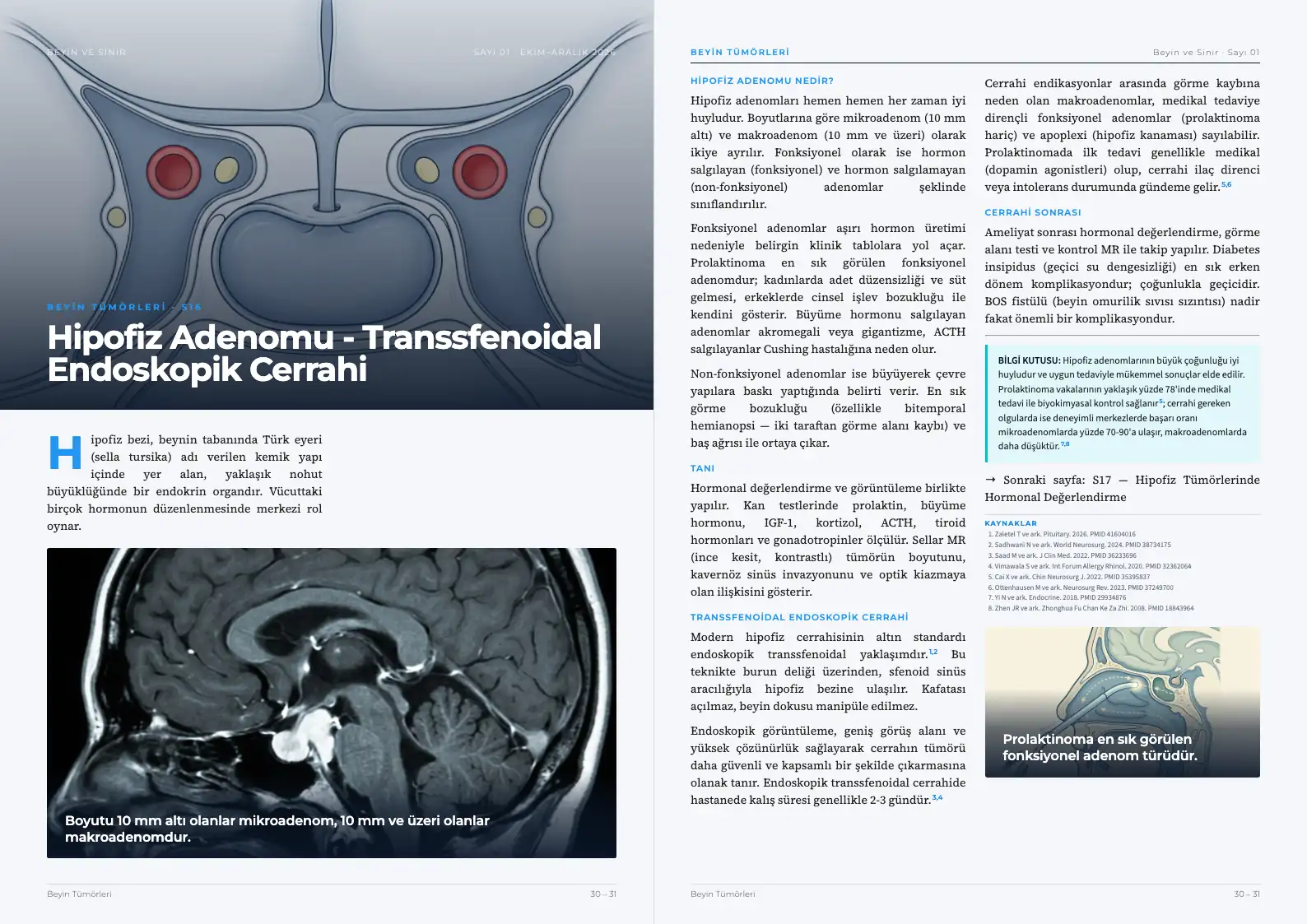 Beyin ve Sinir Sayı 01 — Hipofiz Adenomu - Transsfenoidal Endoskopik Cerrahi · s. 30–31