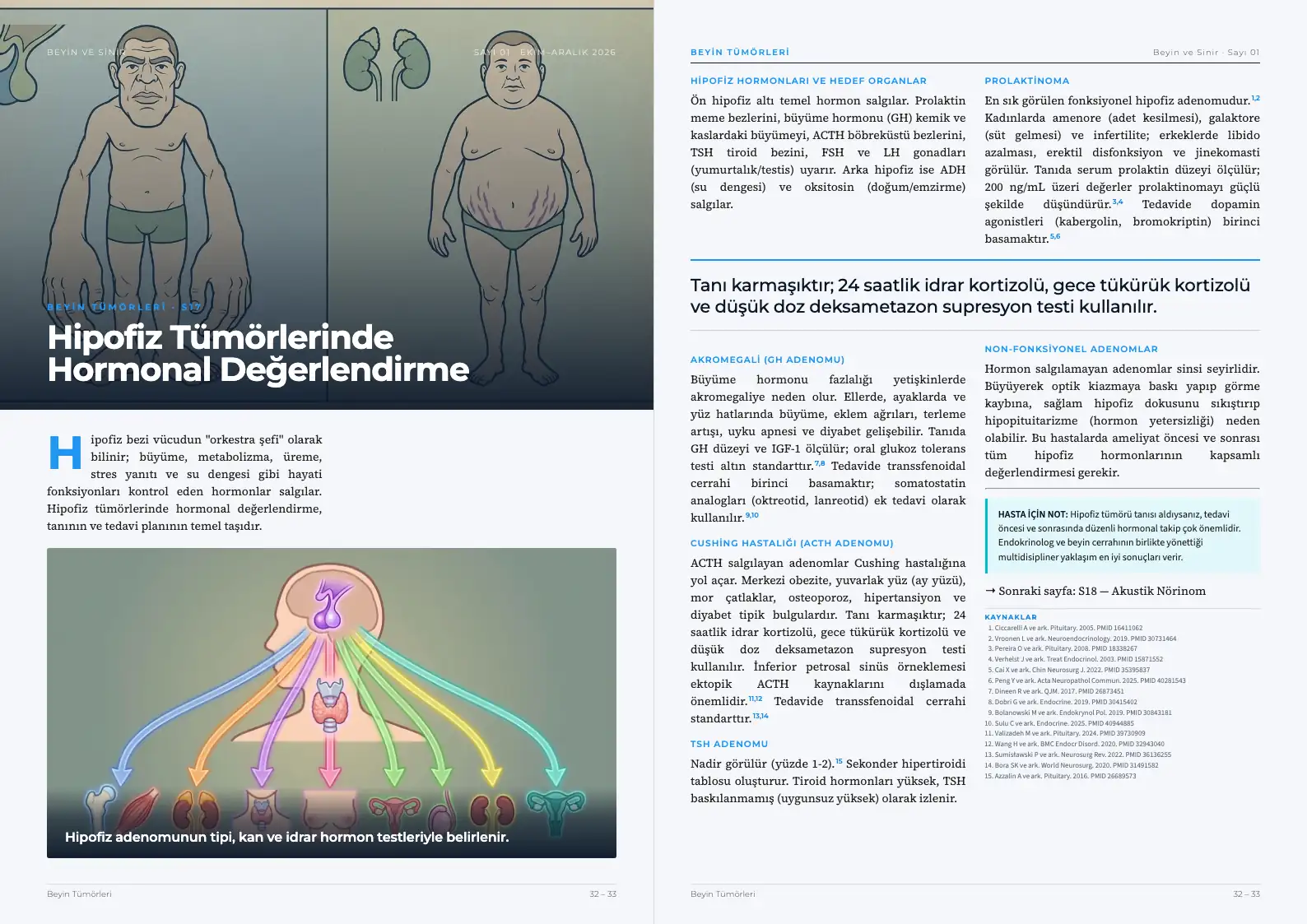 Beyin ve Sinir Sayı 01 — Hipofiz Tümörlerinde Hormonal Değerlendirme · s. 32–33