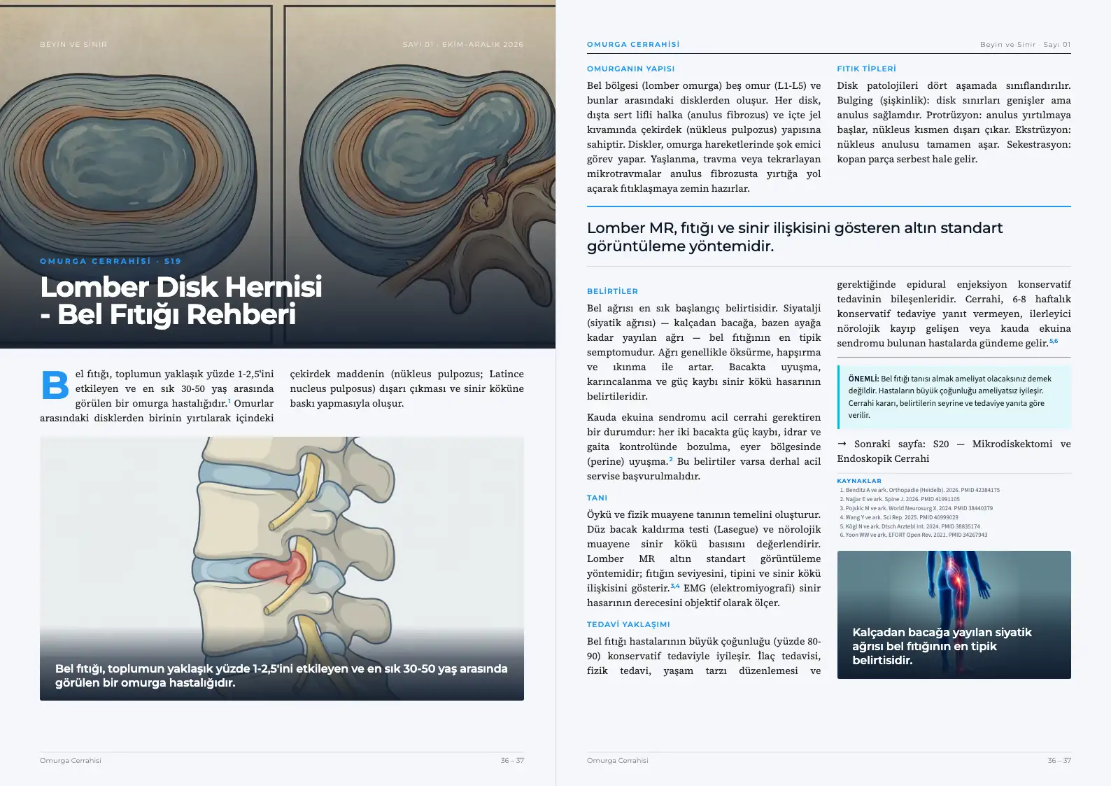 Beyin ve Sinir Sayı 01 — Lomber Disk Hernisi - Bel Fıtığı Rehberi · s. 36–37