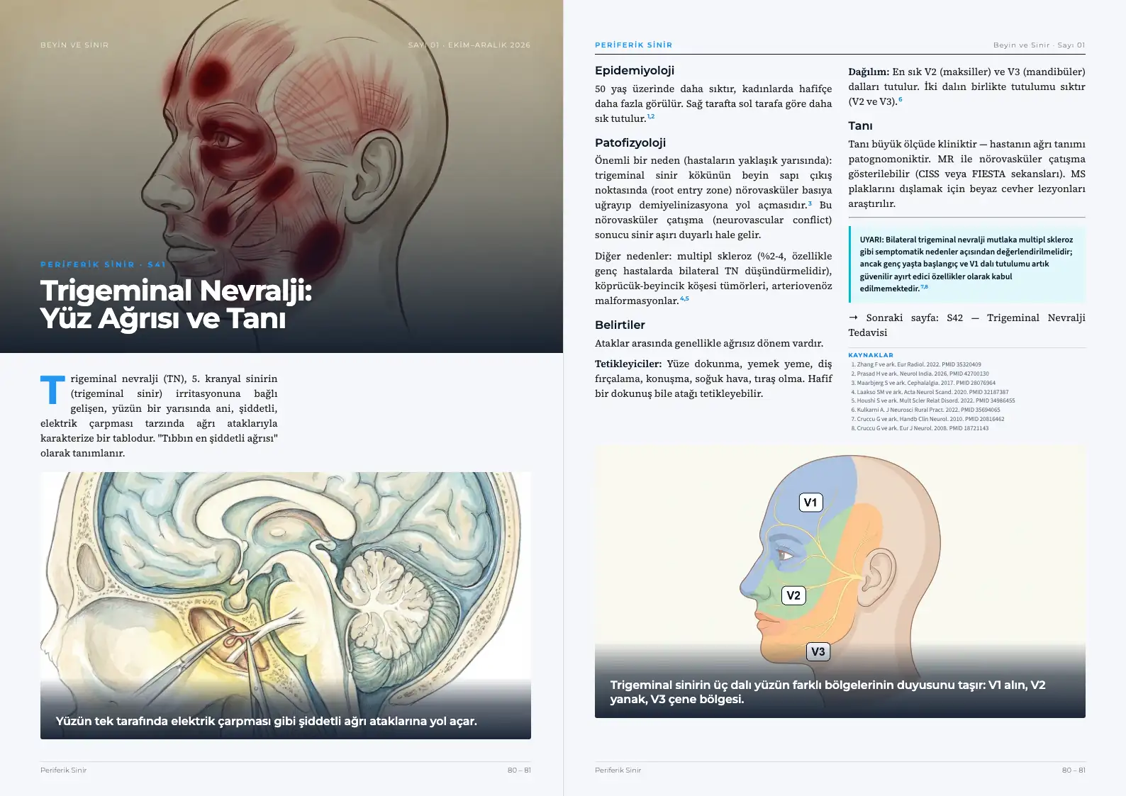Beyin ve Sinir Sayı 01 — Trigeminal Nevralji: Yüz Ağrısı ve Tanı · s. 80–81
