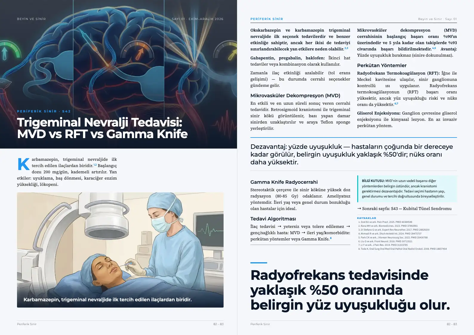 Beyin ve Sinir Sayı 01 — Trigeminal Nevralji Tedavisi: MVD vs RFT vs Gamma Knife · s. 82–83