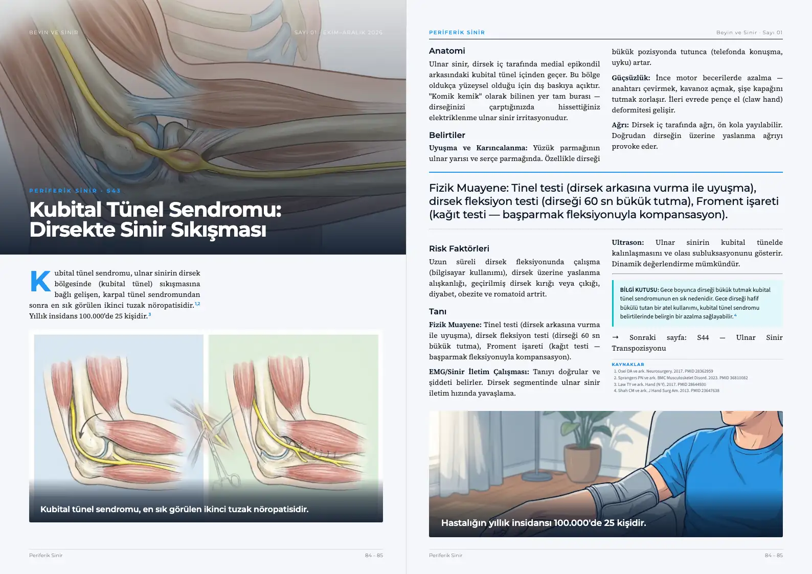 Beyin ve Sinir Sayı 01 — Kubital Tünel Sendromu: Dirsekte Sinir Sıkışması · s. 84–85