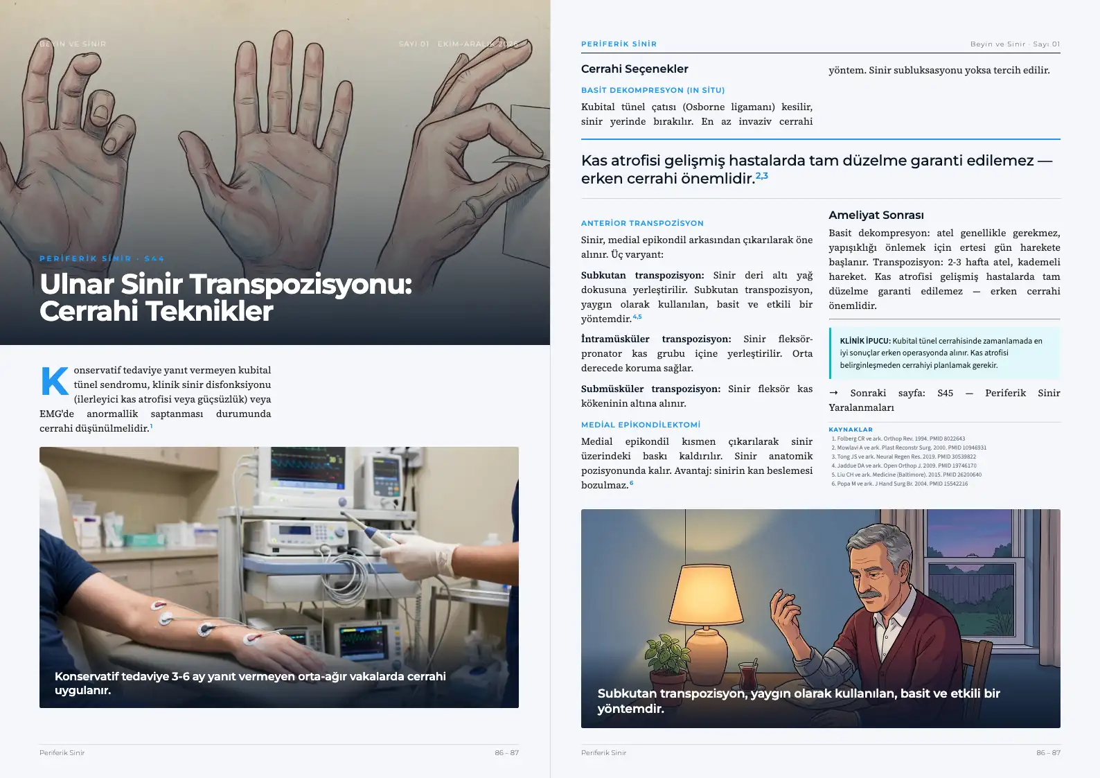 Beyin ve Sinir Sayı 01 — Ulnar Sinir Transpozisyonu: Cerrahi Teknikler · s. 86–87