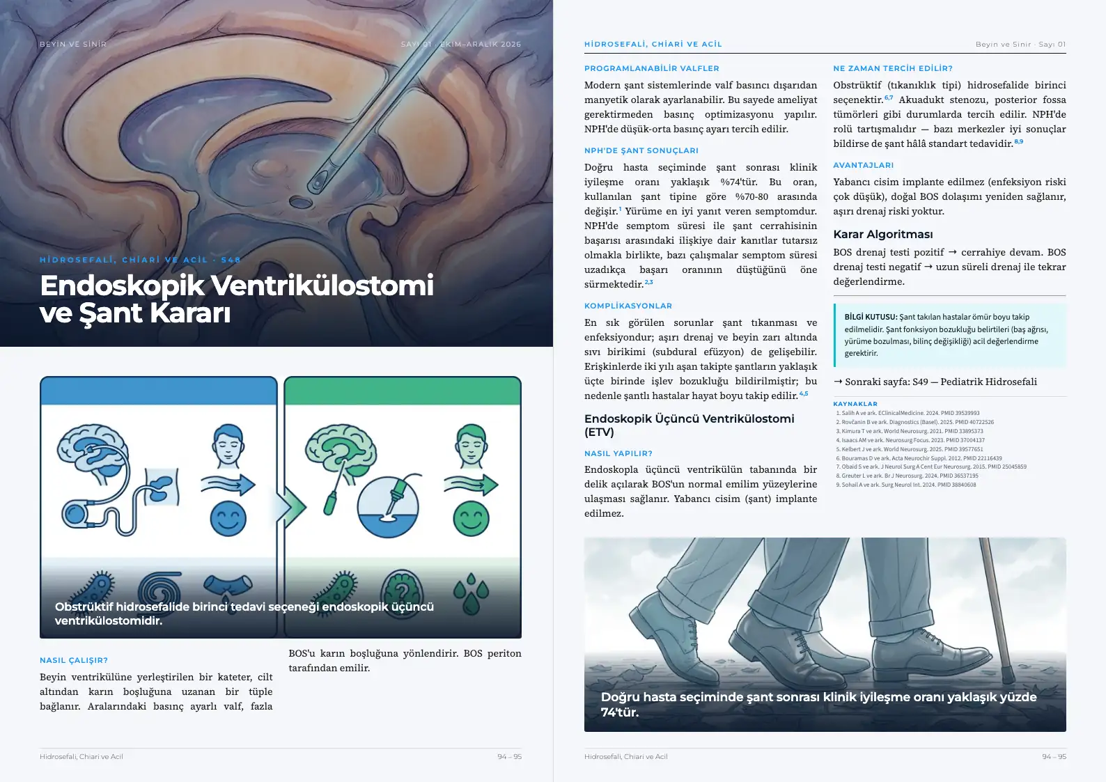 Beyin ve Sinir Sayı 01 — Endoskopik Ventrikülostomi ve Şant Kararı · s. 94–95